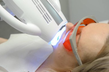 close-up of a womans face under apparatus Beyond Poluse Plus Advanced Whitening System with Dental UV Laser Whitening Device in glasses protective against ultraviolet whitening teeth