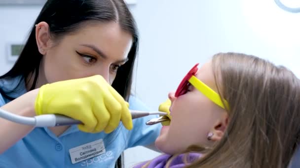 Tandfyllning Hos Barn Mjölktänder Försämras Snabbt Tandläkare Blåser Luft Karies — Stockvideo