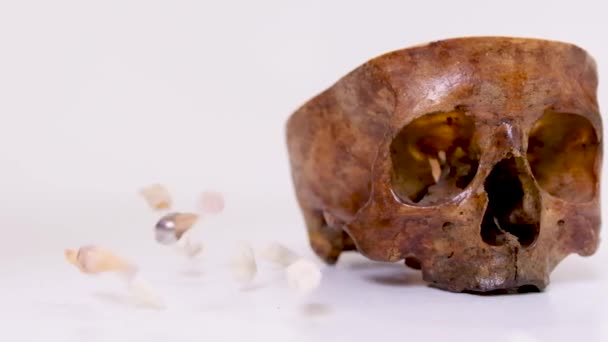 Crânio Humano Real Seção Lado Sabedoria Dentes Pessoas Reais Servem — Vídeo de Stock