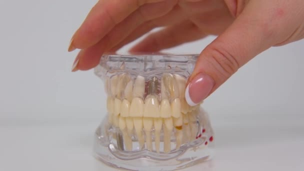 Jaw Model Demonstrate All Dental Diseases Plastic Teeth Woman Hand — Stock video