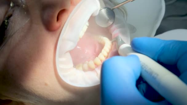 口腔ミラーを使用して歯垢石唾液エジェクターを除去歯を磨く密接な女性歯科用ブラッシング最新の技術サンドブラスターゴーグル水が両側にこぼれ落ちる口の拡大 — ストック動画