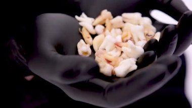 Siyah lateks eldivenli bir avuç dolusu diş, dişleri söküyor stomatolojik diş tedavisi, tedavi edilemez bir doktor.