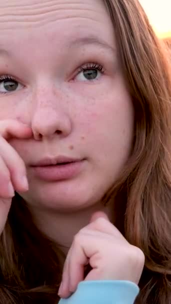 Não Toques Teu Rosto Menina Esfregando Olho Com Mãos Sujas — Vídeo de Stock
