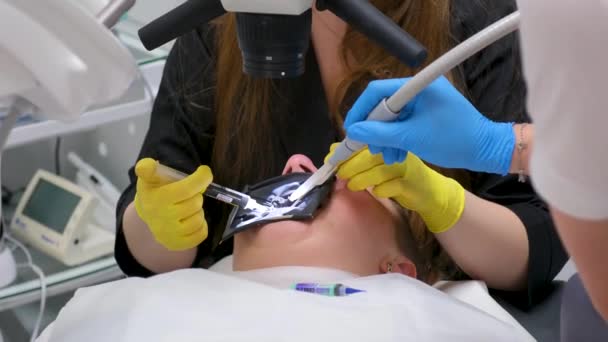 Σύνθετο Υλικό Εστιατορίου Οδοντίατρος Υλικό Πλήρωσης — Αρχείο Βίντεο