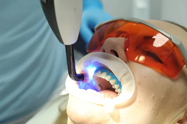 Dentysta Stosuje Żel Wybielający Zębów Pacjentów Klinice Dentystycznej Płynny Cofferdam — Zdjęcie stockowe