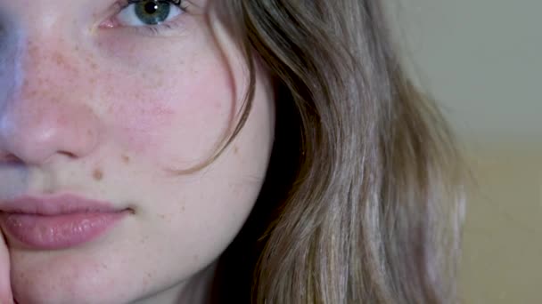 十代の女の子の顔とともにそばかすアップ思春期の皮膚変更顔上の赤い斑点美少女腫れ目アレルギーバルクリンゴ大円形顔光化粧ヨーロッパの子供 — ストック動画