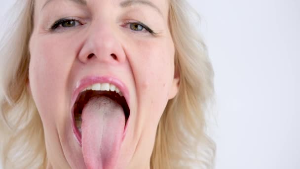 顎外科医または歯列矯正医との任命でかわいい女性 ブロンドは口を大きく開けて舌を突き出して検査する — ストック動画