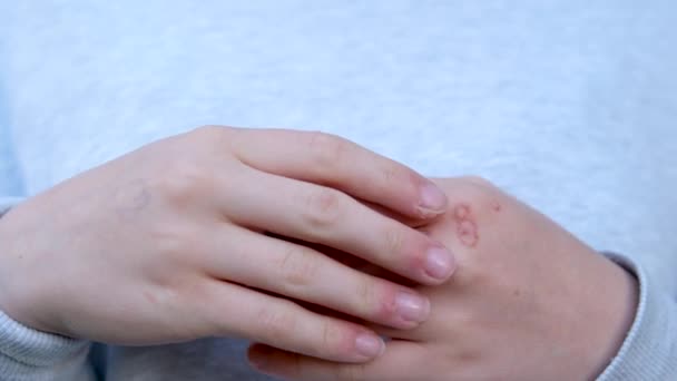 Ruka Bradavicemi Muž Kůže Detailní Ruce Mladé Dospívající Dívky Jsou — Stock video