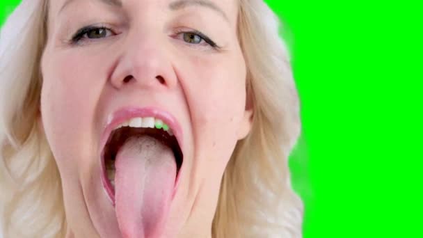 顎外科医または歯列矯正医との任命でかわいい女性 ブロンドは口を大きく開けて舌を突き出して検査する — ストック動画