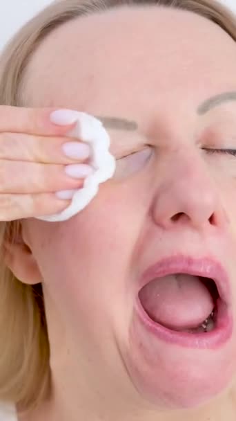 Kvinna Felaktigt Tar Bort Makeup Gnugga Hårt Ansiktet Med Svamp — Stockvideo