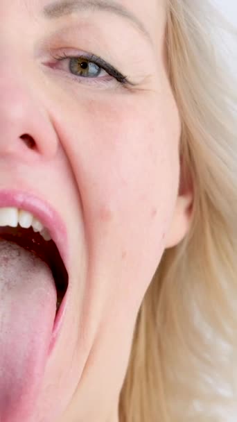 与医生 下巴外科医生或牙齿矫正师预约时 一位漂亮的妇女 金发姑娘张大嘴 伸出舌头检查 后续行动 — 图库视频影像