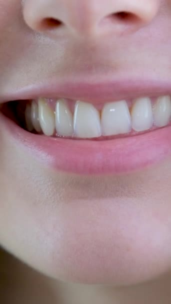 健康的な白い歯を持つ若い新鮮な女性の美しい広い笑顔 背景に隔離された完璧な白い歯を持つ魅力的な女の子の笑顔を閉じます 完璧な白い歯と笑顔 — ストック動画