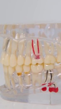 Beyaz arka plan yansıması üzerine taklit Jaws dişler iskelet plastik implant eğitim objesi diş kliniği protezleri çıkarılabilir diş alanı en son gösterilen metin teknolojisi için 