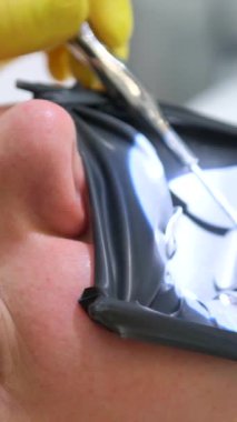 Ortodontik tedavi. Diş telli dişler. Isırık düzeltmesi. İşteki ortodontist. Genç kadın ortodontiste gidiyor. Yüksek kalite 4k görüntü