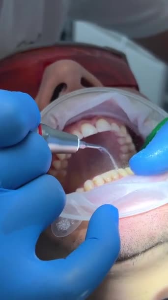 Guanti Sterili Clinica Dentale Medico Uomo Lava Altro Denti Mans — Video Stock