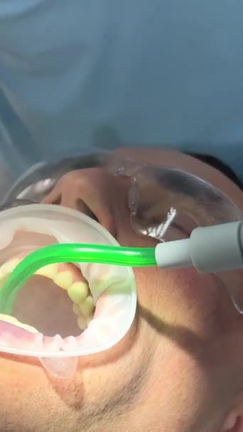 Asistentka Zubařky Během Stomatologické Léčby Zubaře Zubní Lékaři Ošetřující Mužského — Stock video
