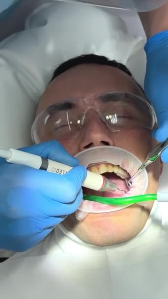 Zubní Ordinace Muž Leží Křesle Ústy Otevřenými Fotoaparát Pomalu Plave — Stock video