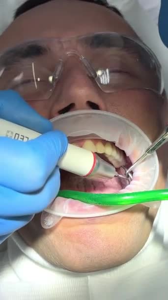 Doctor Blue Gloves Applies Ointment Patients Teeth Shows Plaque Needs — Vídeos de Stock