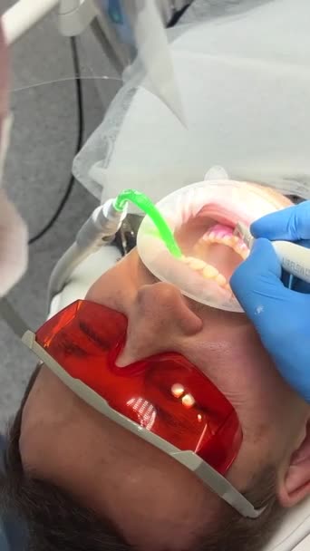 Brushing Teeth Remove Tartar Plaque Dental Care Hygiene Adult Caucasian — Vídeo de Stock