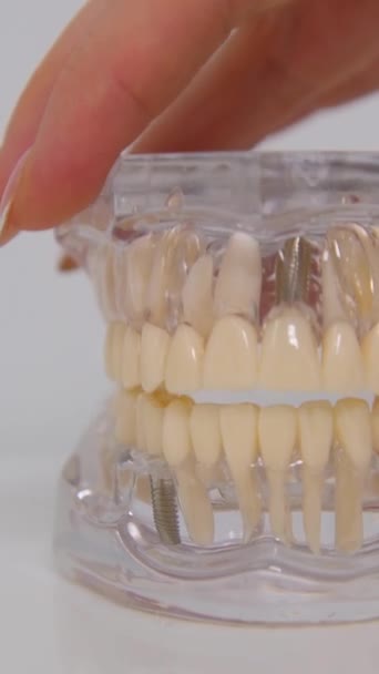 顎のモデルは すべての歯疾患を実証するためにプラスチック歯の女性の手は テキスト歯科のための場所頭蓋骨の顎の白い背景病歯茎チャンネルを開きます — ストック動画