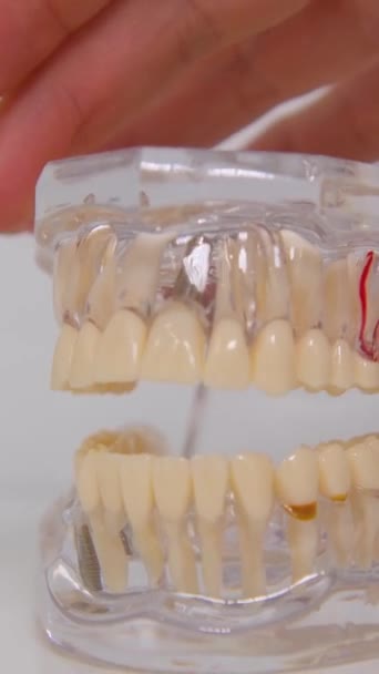 Zubař Předvést Jak Vyčistit Zub Zubní Ordinaci Zubní Model Zubní — Stock video