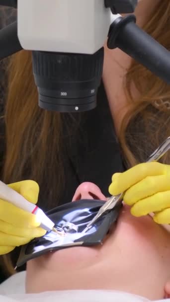 Дорогостоящее Стоматологическое Лечение Помощью Микроскопа Заполняет Каналы Специальными Электронными Инструментами — стоковое видео