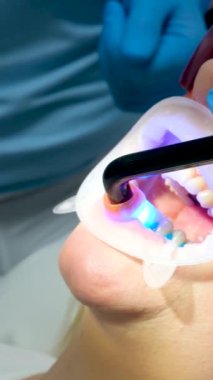 Ağız genişletici sağlıklı dişçi doktor kliniğin kapanışında modern lambayla içini aydınlatıyor. Yüksek kalite 4k görüntü