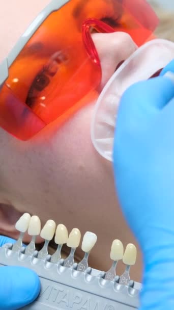 Coloração Dental Clássica Para Determinar Cor Dos Dentes Banner Dente — Vídeo de Stock