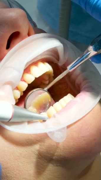 Close Femme Dentisterie Brossage Dents Nettoyage Enlever Les Pierres Plaque — Video