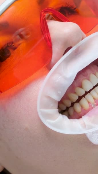Klasické Zubní Barvení Pro Určení Barvy Zubů Zubní Kliniky Pomocí — Stock video