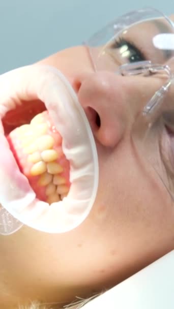 Opresivo Boca Expansor Mujer Silla Dental Boca Celebración Labios Para — Vídeo de stock