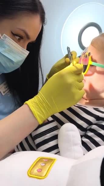 牙科医生在牙科诊所检查儿童牙齿的一部分 高质量的照片 — 图库视频影像