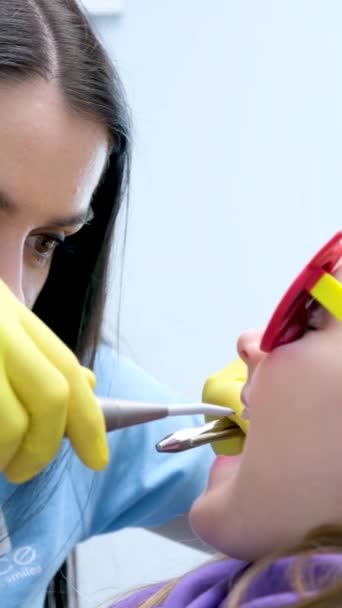 Зубна Начинка Дітей Молочними Зубами Швидко Погіршується Стоматолог Вдихає Повітря — стокове відео