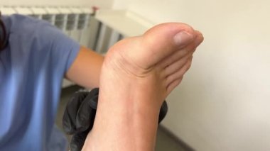 Donanım pedikürü, ayak tedavisi. Elektrikli alet kullanan profesyonel donanım pedikürü. Tıbbi pedikür prosedürü olan bir müşteri. Ayak hastalıkları kliniği. Podoloji. Yüksek kalite 4k görüntü