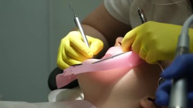 Diş hekimliği ergenliği, sarı eldivenli bir doktor dişçide dişçiye yakın çekim videosu için genç bir kızın dişini doldurur ve dişini yeni teknolojilerle kurutur. modern klinik