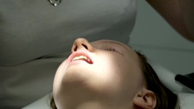 Diş hekimliği ergenliği, sarı eldivenli bir doktor dişçide dişçiye yakın çekim videosu için genç bir kızın dişini doldurur ve dişini yeni teknolojilerle kurutur. modern klinik