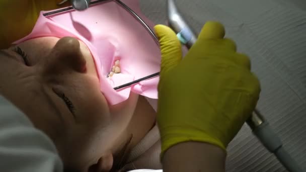 黄色い手袋の歯科医が若い女の子の歯を埋めます 歯医者で歯医者を閉じるビデオ 明るい新しい技術で歯を乾かす 現代クリニック — ストック動画