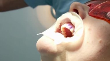 Bir diş kliniğinde diş temizliği, taş ve plaket çıkarmak, bir kadınla çalışan genç uzmanlar, salya püskürtücüsünü temizlemek, tükürük emmek, dişlere boya sürmek,