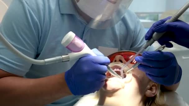 Professionele Tanden Reinigen Een Tandheelkundige Kliniek Verwijderen Van Stenen Plaque — Stockvideo