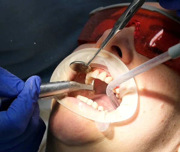 professional teeth cleaning in a dental clinic, removing stones and plaque, young specialists working with a woman, cleaning a saliva ejector, sucking out saliva, applying paint to the teeth