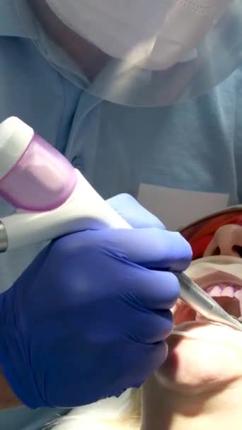 Pulizia Professionale Dei Denti Una Clinica Dentale Rimozione Pietre Placche — Video Stock