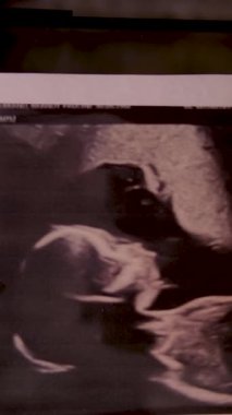 Hamile bir kadının çerçeveli bebek partisi davetiyesindeki fotoğrafının ultrason fotoğrafı. beyaz çerçeveli yeşil bir arkaplanda