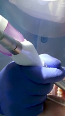Bir diş kliniğinde diş temizliği, taş ve plaket çıkarmak, bir kadınla çalışan genç uzmanlar, salya püskürtücüsünü temizlemek, tükürük emmek, dişlere boya sürmek,