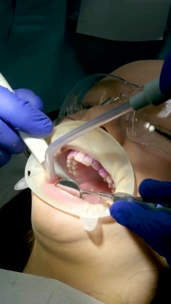 歯科オフィスに座って歯を白くする手で心臓を示す若い少女 医者および看護唾液吸引および青い手袋およびマスクの他の最新技術 自己の世話 — ストック動画