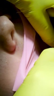 Diş hekimliği ergenliği, sarı eldivenli bir doktor dişçide dişçiye yakın çekim videosu için genç bir kızın dişini doldurur ve dişini yeni teknolojilerle kurutur. modern klinik