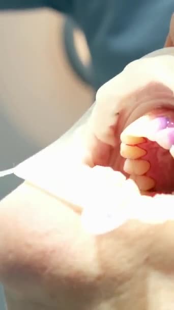 Profesionální Čištění Zubů Zubní Klinice Odstraňování Kamenů Plaku Mladí Specialisté — Stock video