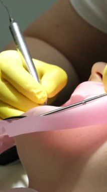 Diş hekimliği ergenliği, sarı eldivenli bir doktor dişçide dişçiye yakın çekim videosu için genç bir kızın dişini doldurur ve dişini yeni teknolojilerle kurutur. modern klinik