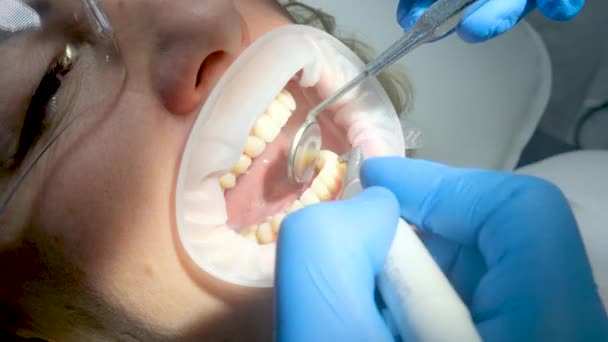 Yakın Plan Kadın Dişçiliği Diş Fırçalama Plaket Taşlarını Temizleme Tükürük — Stok video