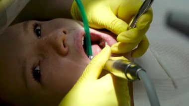 Genç kadın dişçi. Ortodontiste resepsiyon. Diş tellerinin değiştirilmesi. Cilalıyorum. Jel yapıştırma. Yüksek kalite 4k görüntü
