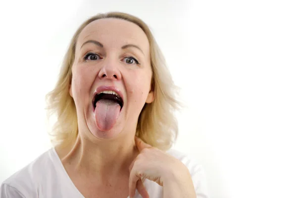 女は舌をきれいにして舌をきれいにした結果を舌に示す 白いコーティングを施した女性の舌 白地に隔離されてる 胃腸病 ロイヤリティフリーのストック写真